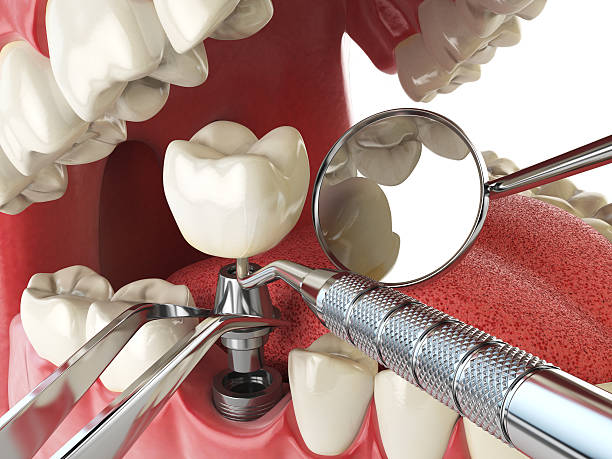 Best Walk-In Emergency Dentist in Randolph, NE